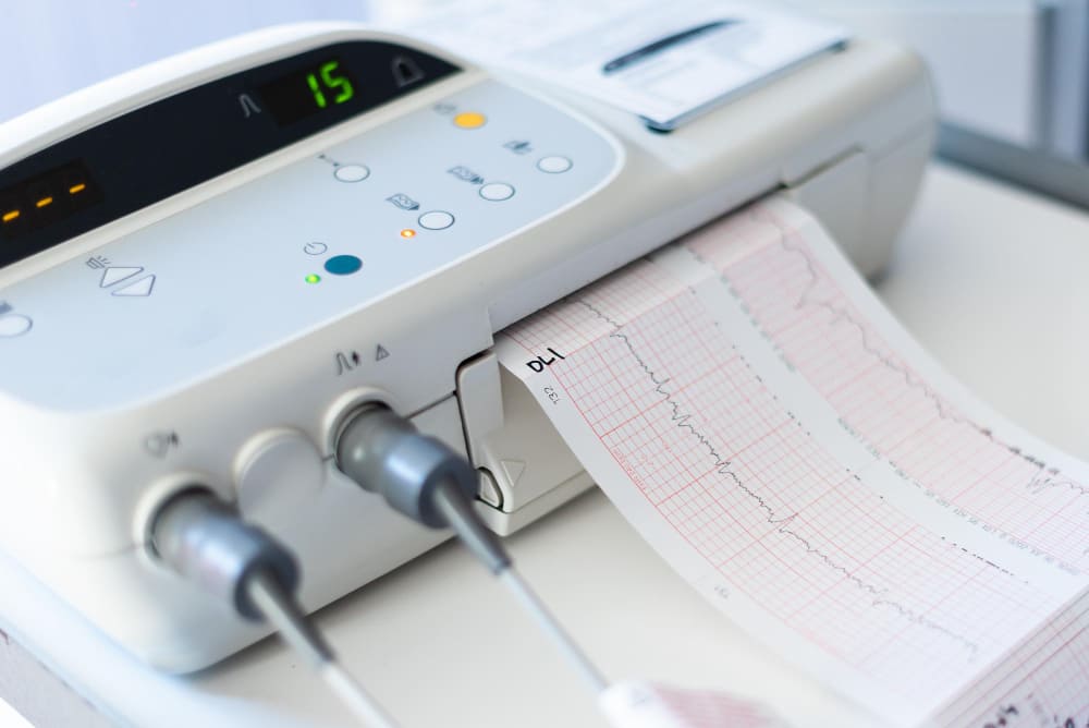 servizio ECG farmacia san lazzaro asti